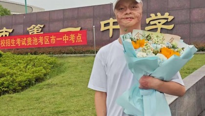 “烧伤男孩”高考664分被东南大学录取：曾经历23次手术，计划未来读研读博