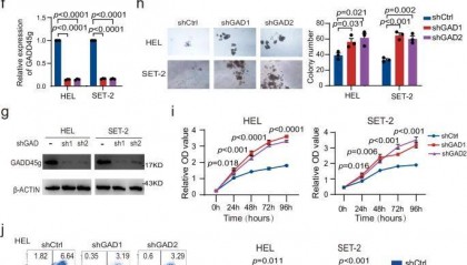 骨髓瘤相关生物标志物研究：LabEx多因子检测平台助力