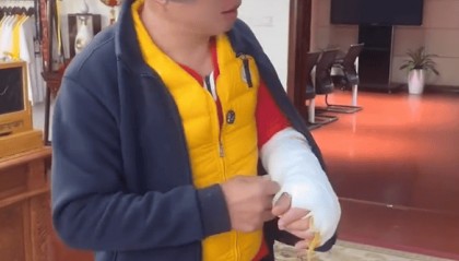 周黑鸭创始人被卡磁炉炸伤