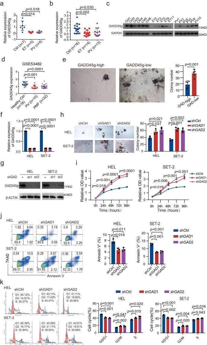 骨髓瘤相关生物标志物研究：LabEx多因子检测平台助力
