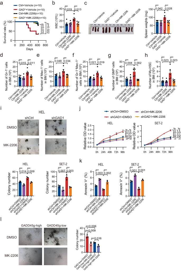 骨髓瘤相关生物标志物研究：LabEx多因子检测平台助力