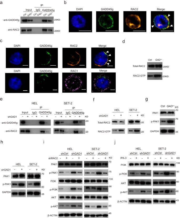 骨髓瘤相关生物标志物研究：LabEx多因子检测平台助力